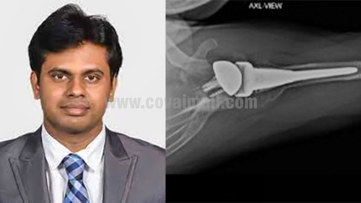 Royal Care Hospital Performs Successful Reverse Shoulder Replacement Surgery on 72-Year-Old