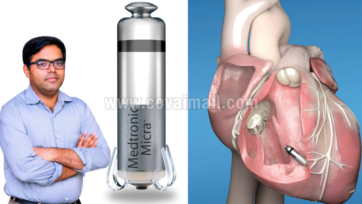 A New Era in Cardiac Pacing; World’s tiniest dual-chamber leadless pacemaker implanted at PSG